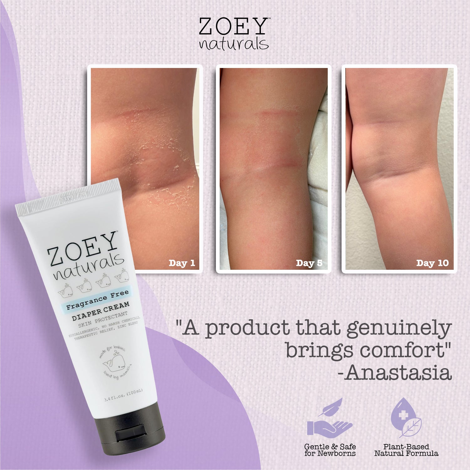 Zoey Naturals | Diaper Rash Cream – Absolutely Natural | Healthy